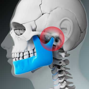 Cirurgia Ortognática – Dr. Aluísio Galiano