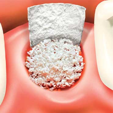 Cirurgia Ortognática – Dr. Aluísio Galiano