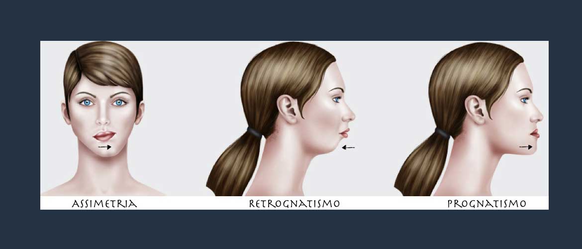 Cirurgia Ortognática – Dr. Aluísio Galiano