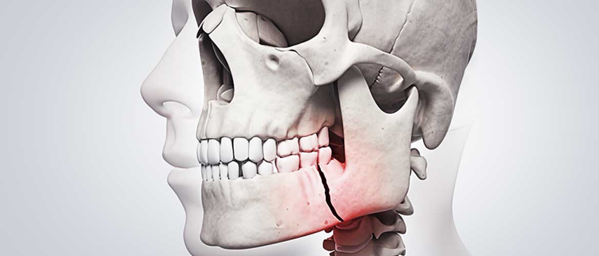 dr-aluisio-slider--traumatologia